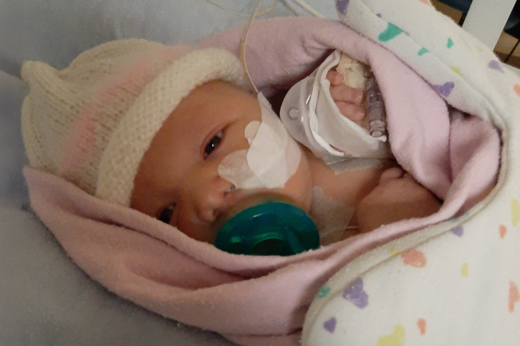 An infant Hailey is nestled in a crib, wrapped in pink blankets, with a knitted hat on her small head. She looks toward the camera, her chest and hand are bandaged, and there is a breathing tube in her nose.